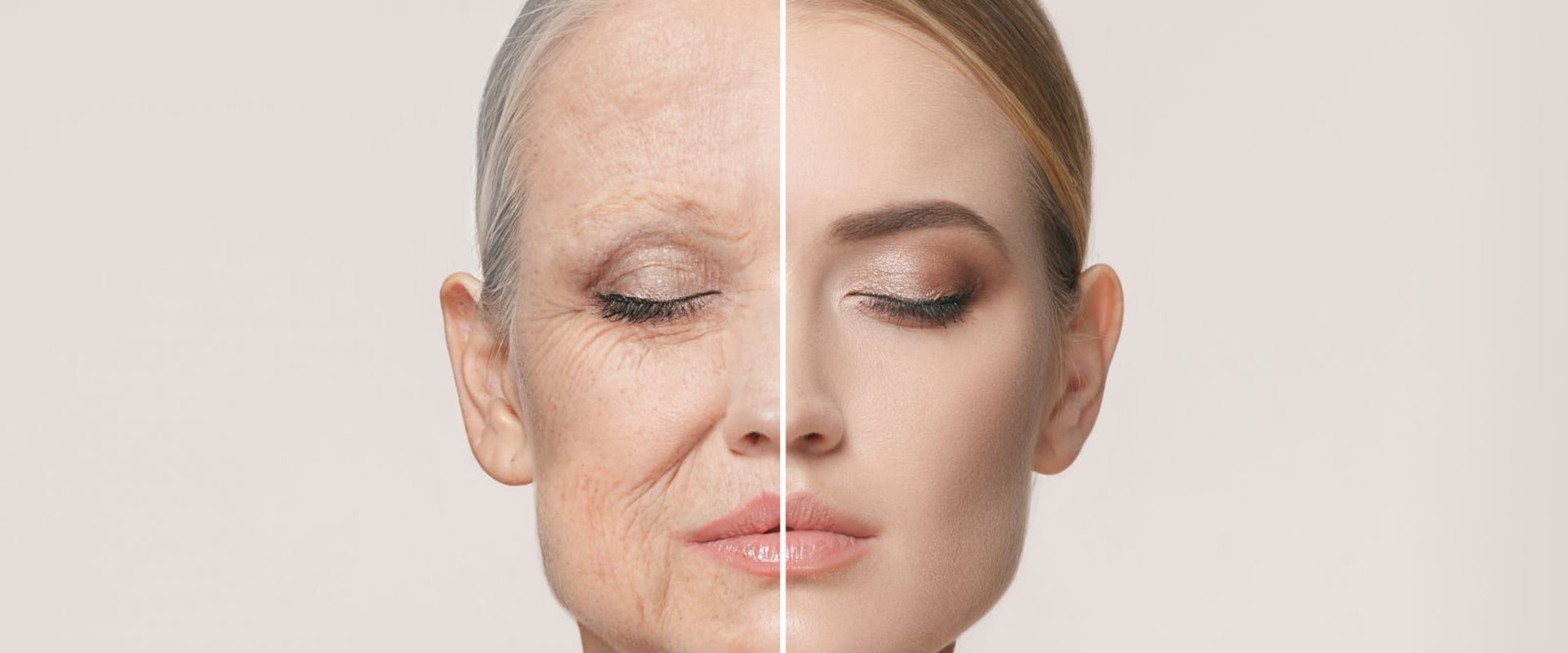The Age-Defying Effects of a Facelift