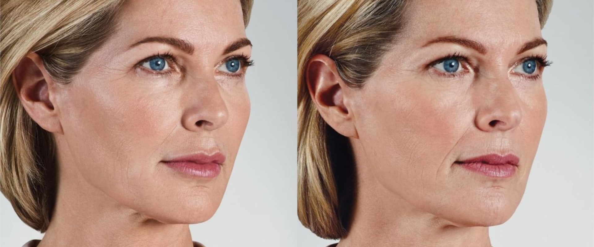 How to metabolize fillers faster at home?