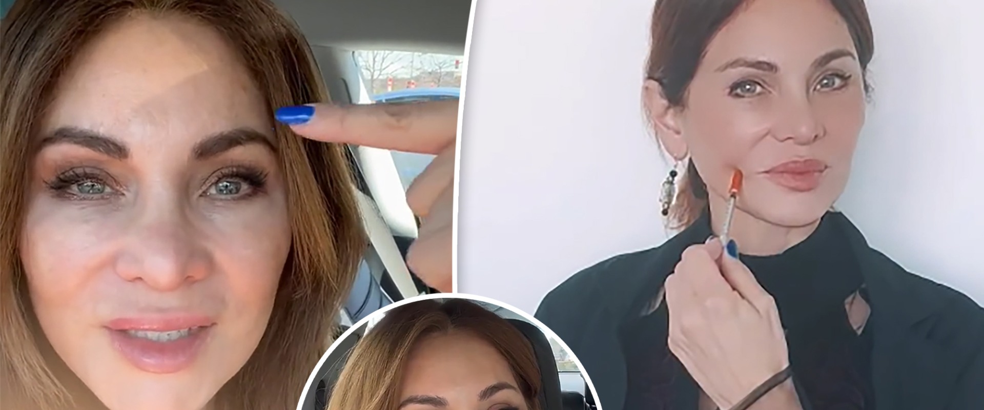 What happens if you don't keep up with face fillers?