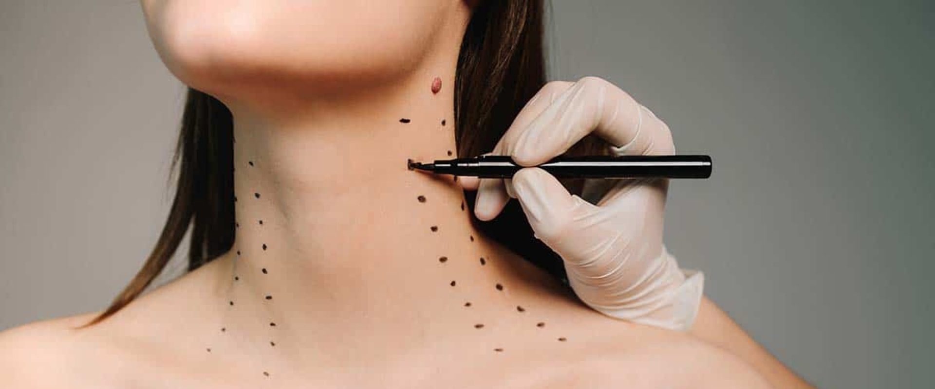 Nefertiti Neck Lift: Revolutionary Non-Surgical Neck Rejuvenation