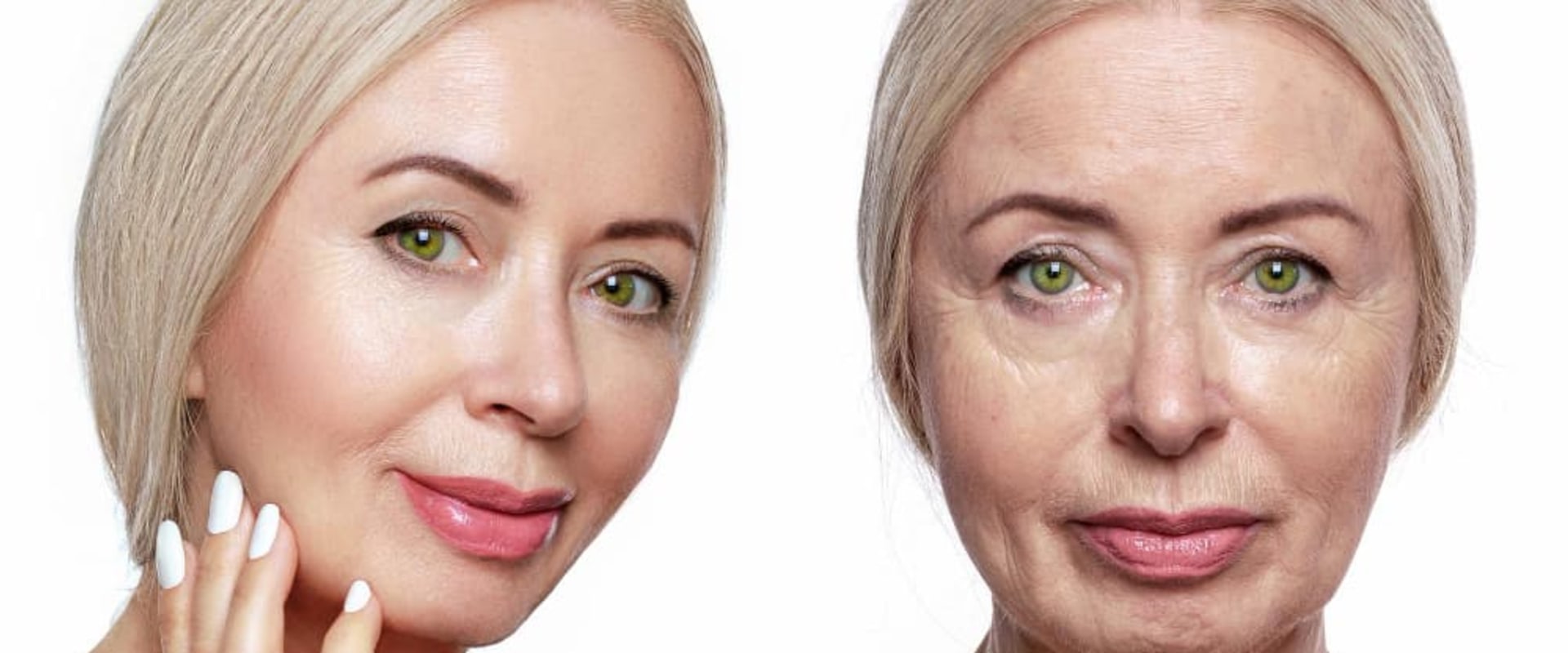 What is the price of a facelift in turkey?