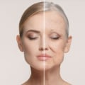 The Age-Defying Effects of a Facelift