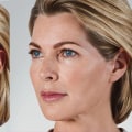 How to metabolize fillers faster at home?
