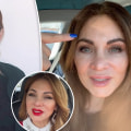 What happens if you don't keep up with face fillers?