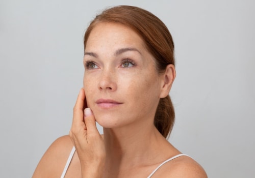 Can people tell if you've had a facelift?