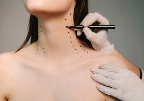 Nefertiti Neck Lift: Revolutionary Non-Surgical Neck Rejuvenation